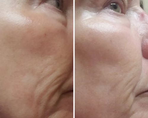 Anti-Aging Technology