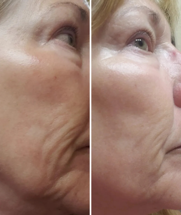 Anti-Aging Technology